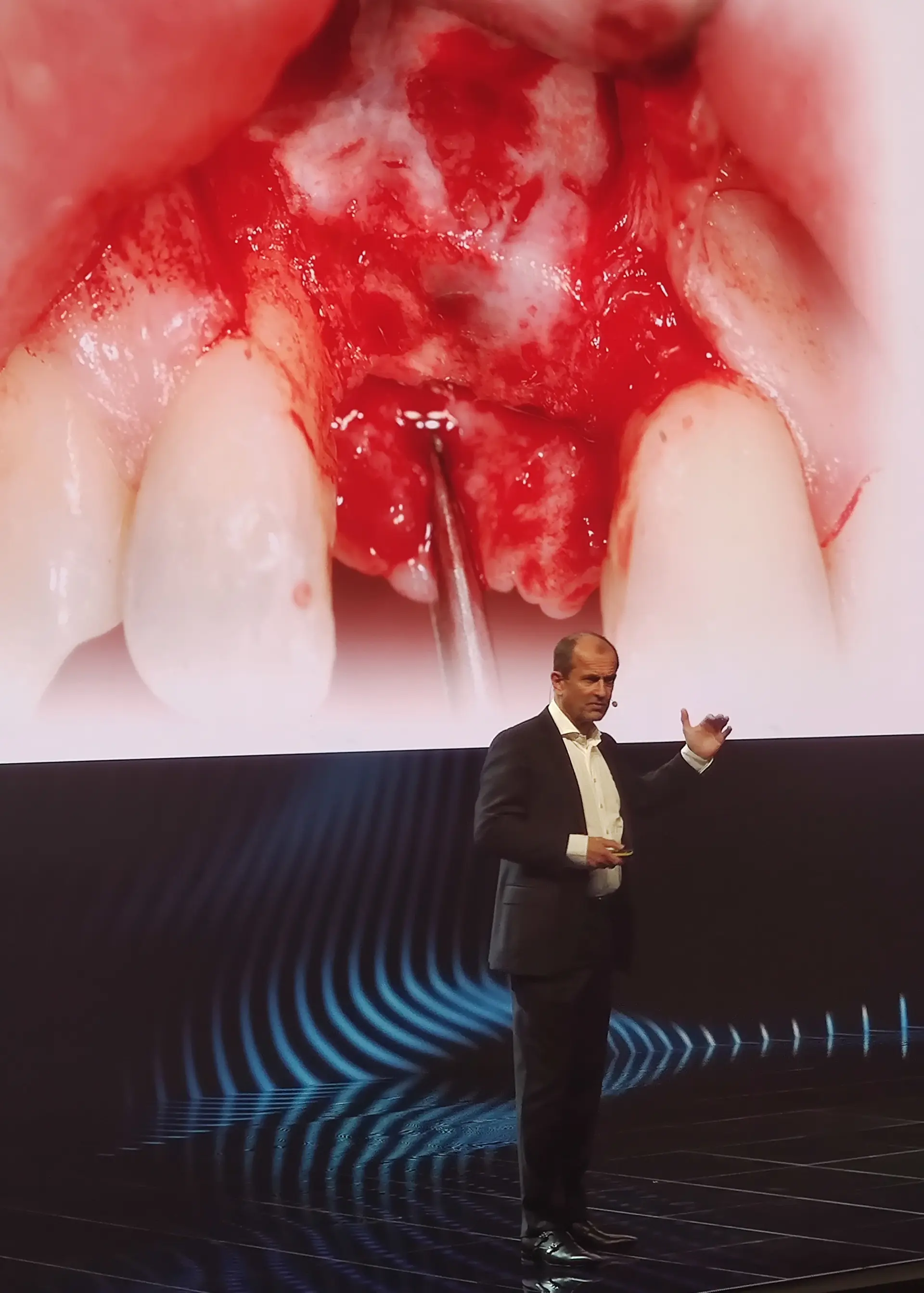 Dr. Norbert Haßfurther als Speaker zum Thema Implantologie in London