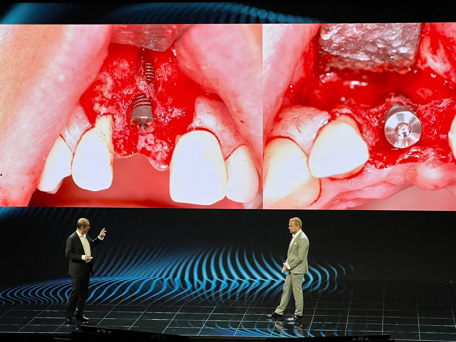Dr. Norbert Haßfurther und Dr. Nicolas Haßfurther als Referenten beim Implantologie-Kongress in Göteborg, Schweden.